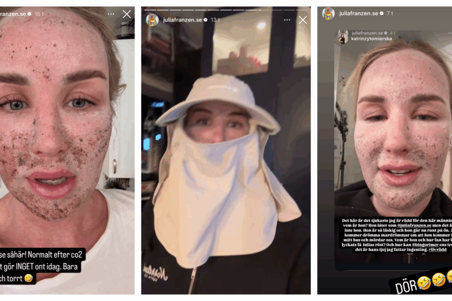 Vad har hänt med julia franzéns ansikte?