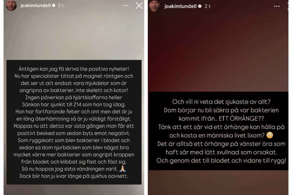 Jonnas sepsis orsakades av ett örhänge